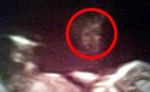Vegheat de un "inger" in uterul mamei. Ecografia care i-a lasat pe parinti muti de uimire