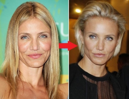 Dupa ce si-a pus silicoane, a apelat si la botox. Cameron Diaz are fata incremenita Dupa ce si-a pus silicoane, a apelat si la botox. Cameron Diaz are fata incremenita