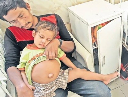 Prima fotografie cu baietelul din Peru, "insarcinat" cu fratele sau geaman