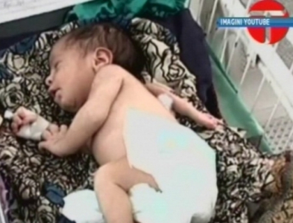 Pana si medicii au ramas ingroziti! O fetita cu 3 maini s-a nascut intr-un spital din Pakistan Pana si medicii au ramas ingroziti! O fetita cu 3 maini s-a nascut intr-un spital din Pakistan