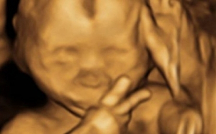Semnul facut de un bebelus din pantecele mamei i-a lasat pana si pe medici muti de uimire. FOTO Semnul facut de un bebelus din pantecele mamei i-a lasat pana si pe medici muti de uimire. FOTO