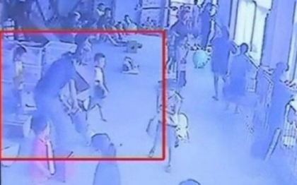 A suferit un traumatism cranian la numai 4 ani din cauza profesoarei sale. Imagini socante