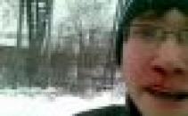 Cameraman pocnit in fata, de unul dintre tinerii pe care ii intarata sa se bata! VEZI VIDEO