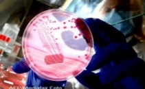 Povestea senzationala a femeii care s-a tratat de E.Coli cu medicamente interzise de OMS Povestea senzationala a femeii care s-a tratat de E.Coli cu medicamente interzise de OMS