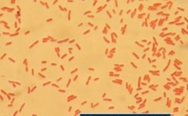 Epidemie in Germania. O bacterie contagioasa a ucis 2 oameni. Cum se transmite