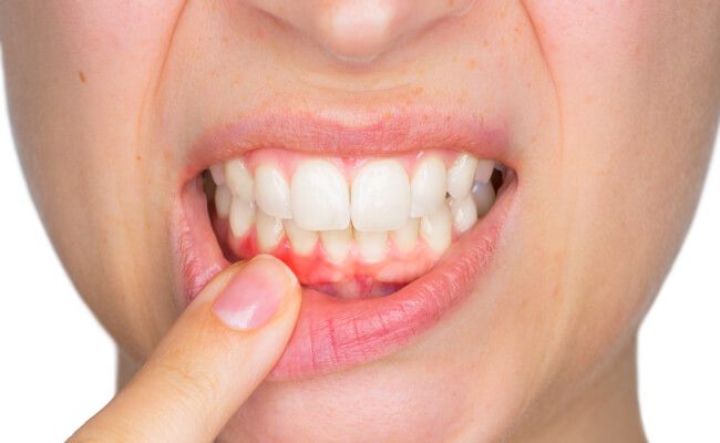 poate dintele rău să provoace pierderea în greutate