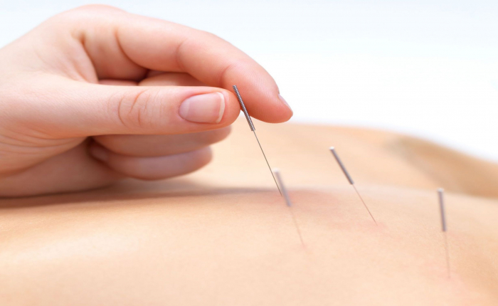Beneficiile acupuncturii in maladiile si infertilitate la femei. Alina Bodrug, reflexoterapeut: „Indicatiile acupuncturii sunt extrem de diverse, avand beneficii la nivelul tuturor sistemelor de organe” - VIDEO