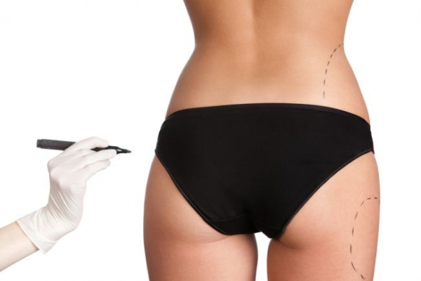Scapa de cativa centimetri in plus cu ajutorul LIPOSUCTIEI - VIDEO Scapa de cativa centimetri in plus cu ajutorul LIPOSUCTIEI - VIDEO