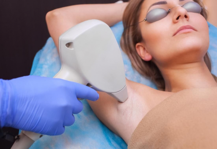 Epilarea cu laser - una dintre cele mai populare metode pentru a scapa de parul nedorit. Este totusi o procedura cu rezultat definitiv sau nu