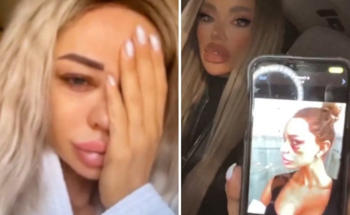 Bianca Dragusanu, imagini socante! A publicat poze dupa ce a fost batuta cu bestialitate in nenumarate randuri