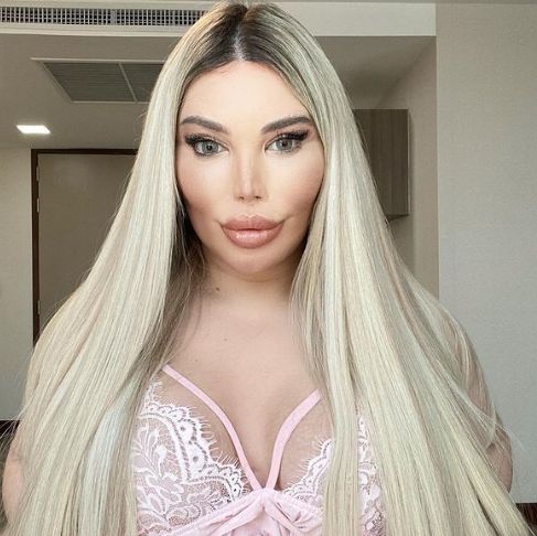 Ce s-a intamplat cu Jessica Alves dupa operatia de schimbare de sex: ”Nu stiu cum sa gestionez asta” Ce s-a intamplat cu Jessica Alves dupa operatia de schimbare de sex: ”Nu stiu cum sa gestionez asta”