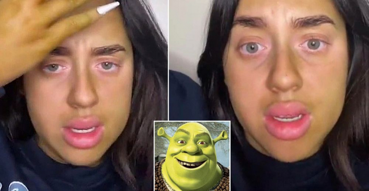 A folosit un autobronzant si pielea ei s-a colorat in verde! "Arat ca Shrek!" Gafa incredibila pe care a facut-o. Imagini senzationale A folosit un autobronzant si pielea ei s-a colorat in verde! "Arat ca Shrek!" Gafa incredibila pe care a facut-o. Imagini senzationale