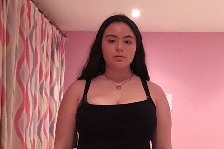 Nu se poate sa fie tot ea! Arata ASA si ii era teama sa se uite si in oglinda, iar colegii radeau de ea! Apoi s-a pus pe slabit. E uluitor cum poate sa arate acum
Nu se poate sa fie tot ea! Arata ASA si ii era teama sa se uite si in oglinda, iar colegii radeau de ea! Apoi s-a pus pe slabit. E uluitor cum poate sa arate acum