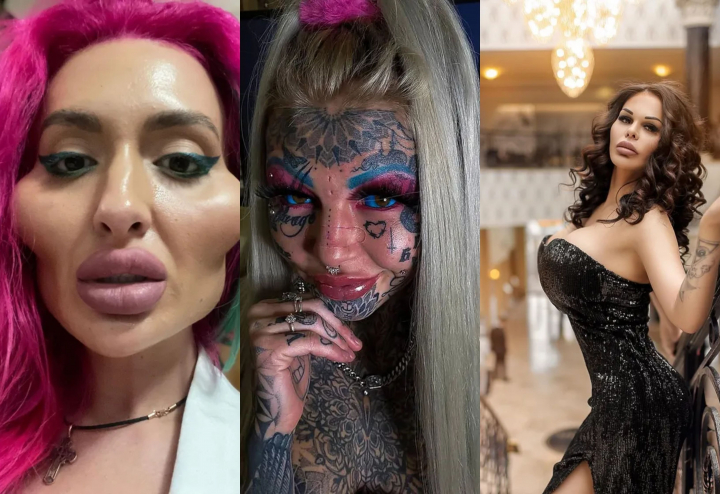 Priviti si ingroziti-va! Aceste fete castiga milioane avand un aspect inspaimantator dupa operatiile estetice - FOTO