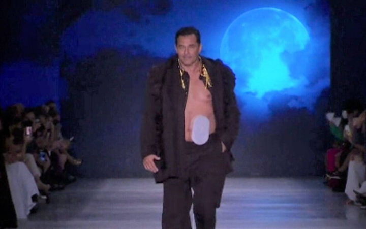 Un actor a defilat pe podimul de la saptamana modei din Sao Paulo cu un dispozitiv medical montat pe abdomen Un actor a defilat pe podimul de la saptamana modei din Sao Paulo cu un dispozitiv medical montat pe abdomen