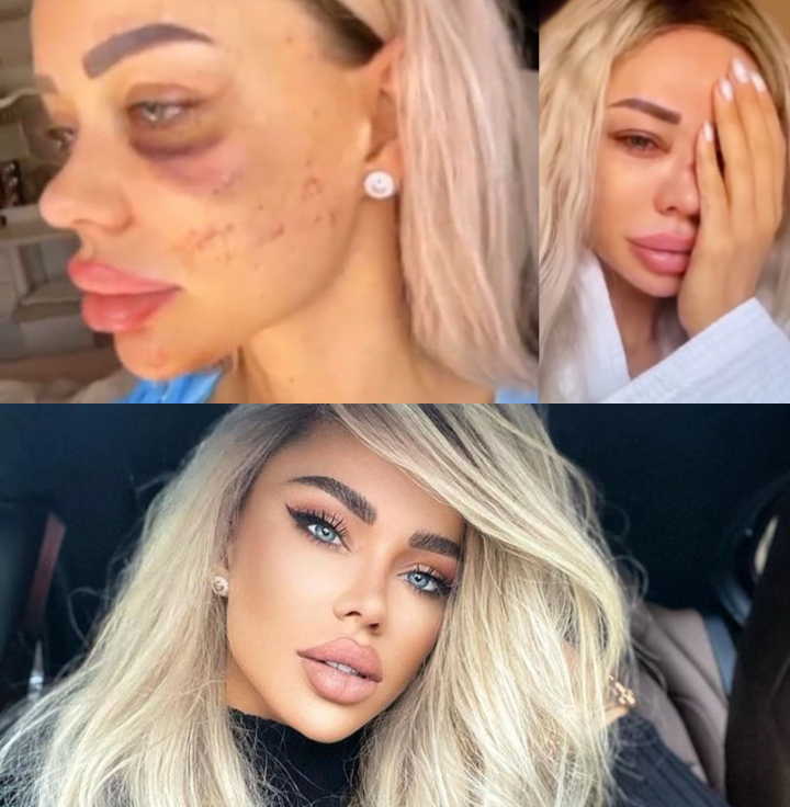 Bianca Dragusanu, adevarul despre relatiile in care a fost batuta: „Regret ca am iertat. Un barbat care ridica mana la tine...” Bianca Dragusanu, adevarul despre relatiile in care a fost batuta: „Regret ca am iertat. Un barbat care ridica mana la tine...”