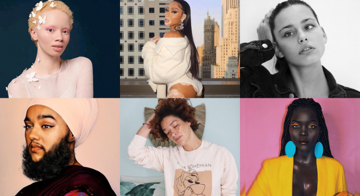 Au demonstrat tuturor ca infatisarea nestandarta isi are farmecul sau! 9 modele a caror aspect fizic este unic si deosebit - FOTO