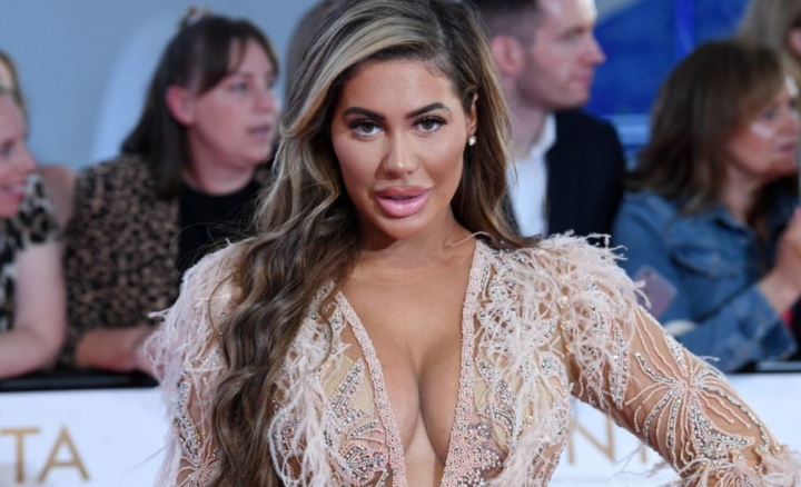 Vedeta britanica pe care operatiile estetice au dus-o la faliment. Este de nerecunoscut Vedeta britanica pe care operatiile estetice au dus-o la faliment. Este de nerecunoscut