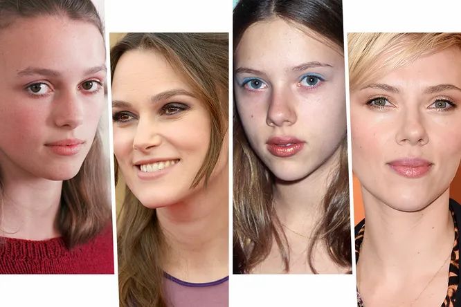 Unele operatii plastice sunt chiar bine-venite! Vezi care sunt vedetele ce si-au corectat nasul cu ajutorul rinoplastiei - FOTO Unele operatii plastice sunt chiar bine-venite! Vezi care sunt vedetele ce si-au corectat nasul cu ajutorul rinoplastiei - FOTO