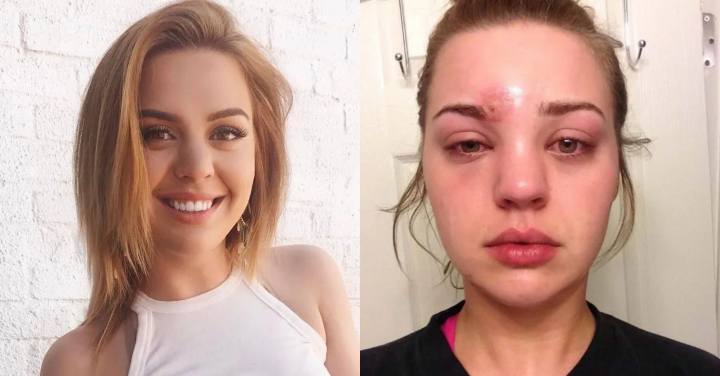 Machiaj mortal! Afla povestea tinerii din SUA, care ar trebui sa iti fie o lectie pentru toata viata: „Aproape ca am platit cu propria mea viata pentru asta” - FOTO Machiaj mortal! Afla povestea tinerii din SUA, care ar trebui sa iti fie o lectie pentru toata viata: „Aproape ca am platit cu propria mea viata pentru asta” - FOTO