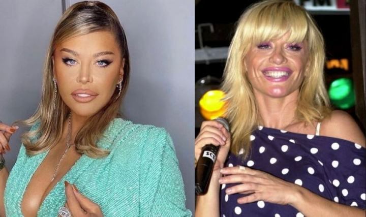Ea spune ca nu s-a operat deloc, dar imaginile o contrazic! Cum arata Loredana Groza inainte, cu dantura imperfecta si fara nasul de „Kim Kardashian” din prezent - FOTO