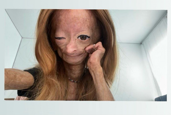 Adalia Rose, vedeta YouTube cu boala "Benjamin Button", a murit la varsta de 15 ani. Familia a facut anuntul dureros Adalia Rose, vedeta YouTube cu boala "Benjamin Button", a murit la varsta de 15 ani. Familia a facut anuntul dureros