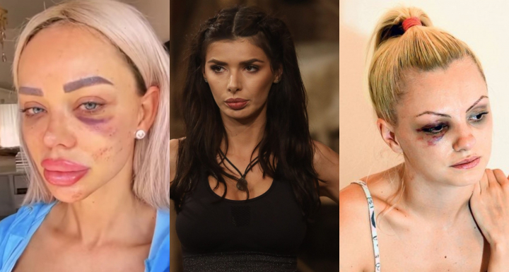 Lista vedetelor din Romania care au fost batute de iubitii lor. Experientele dureroase le-au marcat intreaga viata - FOTO Lista vedetelor din Romania care au fost batute de iubitii lor. Experientele dureroase le-au marcat intreaga viata - FOTO