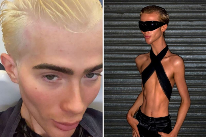 Incredibil! Cum arata Joey Turner la 47 de kilograme: „Sunt slab, nu am ce face” - FOTO
Incredibil! Cum arata Joey Turner la 47 de kilograme: „Sunt slab, nu am ce face” - FOTO