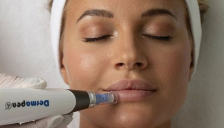 Te confrunti cu buze uscate si deshidratate in perioada rece? Cosmetologul Crisina Stavenschi iti spune totul despre terapia dermapen, care iti garanteaza buze voluminoase si hidratate in doar cateva minute - VIDEO