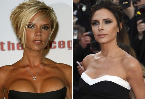 Topul vedetelor care si-au micsorat sanii si au facut din asta o tendinta - FOTO Topul vedetelor care si-au micsorat sanii si au facut din asta o tendinta - FOTO