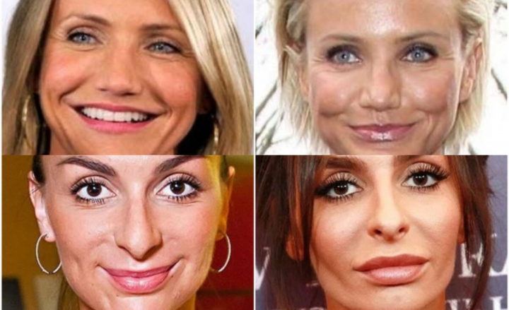 Femei celebre inainte si dupa operatiile plastice. Unele sunt de nerecunoscut - VIDEO Femei celebre inainte si dupa operatiile plastice. Unele sunt de nerecunoscut - VIDEO