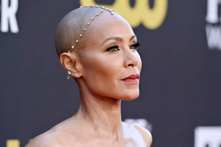 Ce a spus Jada Pinkett Smith despre boala ei inainte cu o saptamana de incidentul de la Oscar. Actrita sufera de alopecie Ce a spus Jada Pinkett Smith despre boala ei inainte cu o saptamana de incidentul de la Oscar. Actrita sufera de alopecie