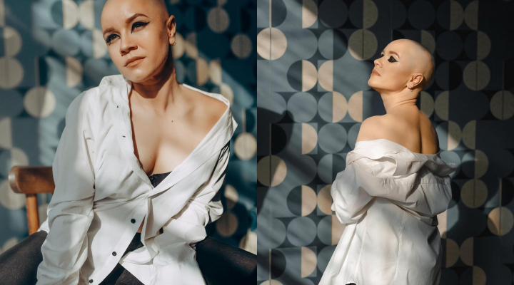 A fost diagnosticata cu alopecie la doar 10 ani! Ce inseamna aceasta maladie si cum se descurca cu ea Ala Milescu: „Femeia ramane feminina si frumoasa indiferent ca ea este cu par sau fara par” - VIDEO