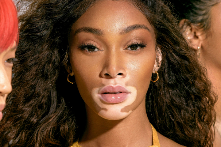 Cum arata acum Winnie Harlow, fotomodelul cu pielea in doua culori. Care e boala de care sufera aceasta - FOTO Cum arata acum Winnie Harlow, fotomodelul cu pielea in doua culori. Care e boala de care sufera aceasta - FOTO