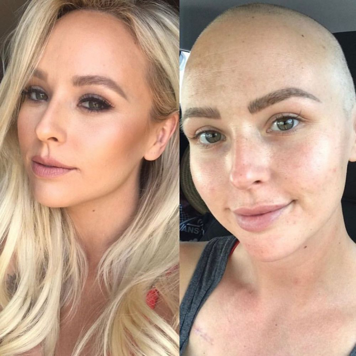 O femeie a aflat ca are cancer mamar in stadiul patru la opt luni de cand medicii au trimis-o acasa: „Mi-au spus ca sunt prea tanara!” - VIDEO