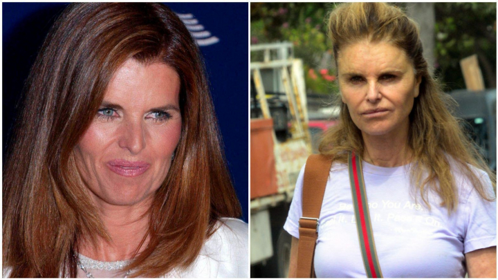 Mutilate de Botox si bisturiu. Ele sunt vedetele care regreta interventiile estetice - FOTO Mutilate de Botox si bisturiu. Ele sunt vedetele care regreta interventiile estetice - FOTO