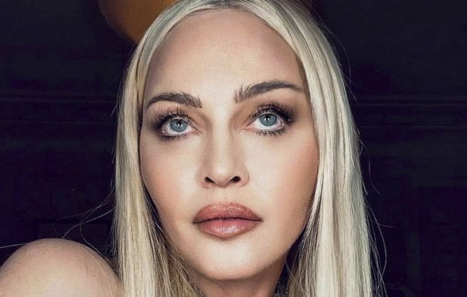 Adevarul despre cele mai recente imagini cu Madonna. Un medic estetician a dezvaluit lista procedurilor la care ar fi apelat artista
