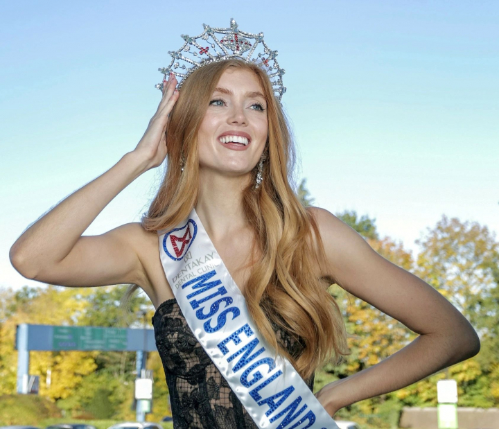 Prima roscata din istorie care a castigat Miss Anglia. In copilarie era ridiculizata, acum e regina frumusetii