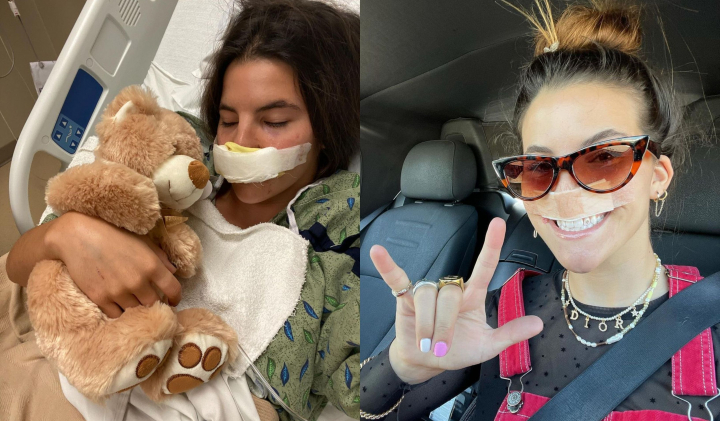 A fost atacata de un pitbull si a ramas fara buza superioara! La doi ani de la cumplitul incident, Brooklinn Khoury si-a aratat fata care a suferit mai multe interventii chirurgicale: „Inca iubesc cainii” - FOTO A fost atacata de un pitbull si a ramas fara buza superioara! La doi ani de la cumplitul incident, Brooklinn Khoury si-a aratat fata care a suferit mai multe interventii chirurgicale: „Inca iubesc cainii” - FOTO