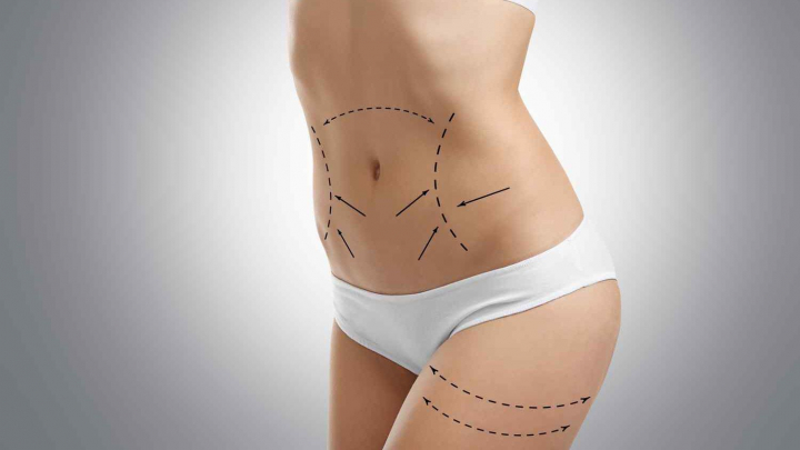 Abdomen de invidiat in doar 60 de minute! Daca iti doresti sa scapi cat mai repede de centimetrii in plus, criolipoliza iti vine in ajutor: „Contraindicatiile procedurii sunt...” - VIDEO Abdomen de invidiat in doar 60 de minute! Daca iti doresti sa scapi cat mai repede de centimetrii in plus, criolipoliza iti vine in ajutor: „Contraindicatiile procedurii sunt...” - VIDEO