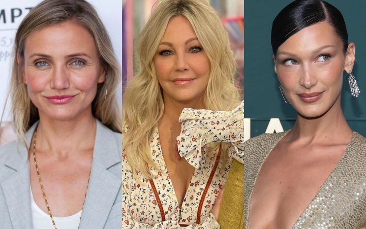 Dive deformate de bisturiu! Aceste vedete de la Hollywood isi regreta operatiile estetice - FOTO Dive deformate de bisturiu! Aceste vedete de la Hollywood isi regreta operatiile estetice - FOTO