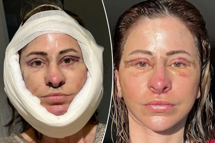 Unde a ajuns sa doarma o femeie de 50 de ani, dupa ce si-a vandut casa pentru operatii estetice. Nu regreta deloc: „Arat fabulos” - FOTO Unde a ajuns sa doarma o femeie de 50 de ani, dupa ce si-a vandut casa pentru operatii estetice. Nu regreta deloc: „Arat fabulos” - FOTO