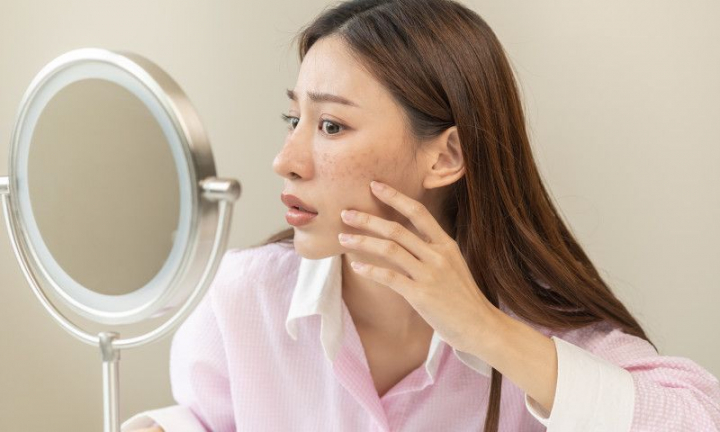 Cum scapi de petele pigmentare cauzate de expunerea la soare. Remedii naturale care nu iti vor afecta pielea
Cum scapi de petele pigmentare cauzate de expunerea la soare. Remedii naturale care nu iti vor afecta pielea