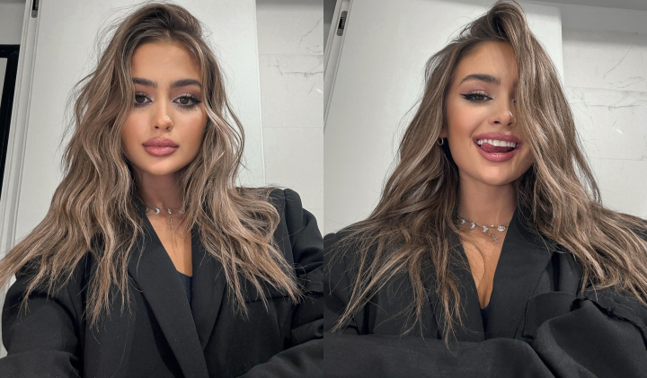 Iuliana Beregoi si-a marit buzele? Ce a povestit interpreta: „Am inceput sa ma iubesc mai mult” - FOTO/VIDEO Iuliana Beregoi si-a marit buzele? Ce a povestit interpreta: „Am inceput sa ma iubesc mai mult” - FOTO/VIDEO