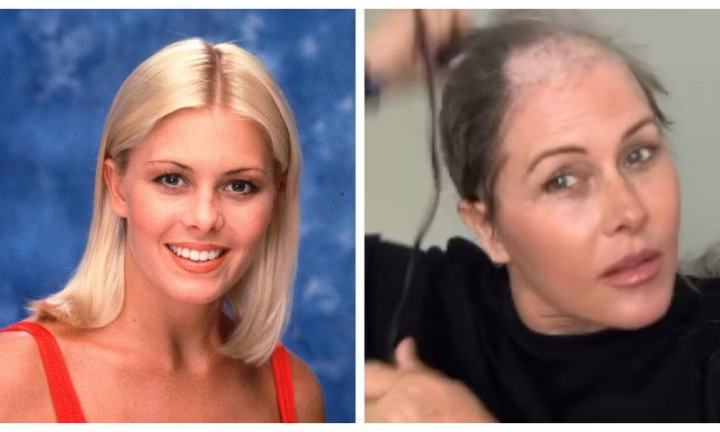 Nicole Eggert, imagini fara filtre. Actrita din „Baywatch” s-a ras pe cap, dupa ce a fost diagnosticata cu o forma rara de cancer
