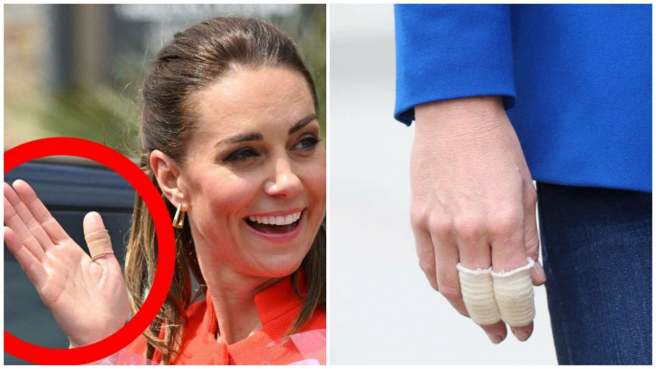 Motivul pentru care printesa de Wales apare mereu cu degetele bandajate. Ce probleme de sanatate ar mai avea Kate - FOTO Motivul pentru care printesa de Wales apare mereu cu degetele bandajate. Ce probleme de sanatate ar mai avea Kate - FOTO