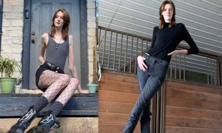 Tânăra cu cele mai lungi picioare din lume, misiune imposibilă să-și găsească un iubit sau blugii potriviți: „Mi-am urât înălțimea”
Tânăra cu cele mai lungi picioare din lume, misiune imposibilă să-și găsească un iubit sau blugii potriviți: „Mi-am urât înălțimea”