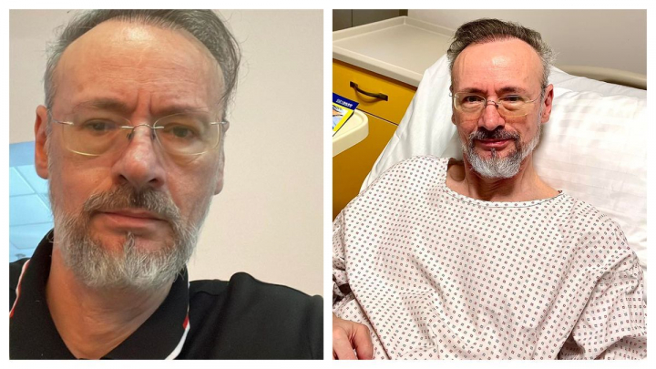 Mihai Albu - diagnosticat cu cancer. Cele mai noi detalii despre starea lui de sănătate Mihai Albu - diagnosticat cu cancer. Cele mai noi detalii despre starea lui de sănătate