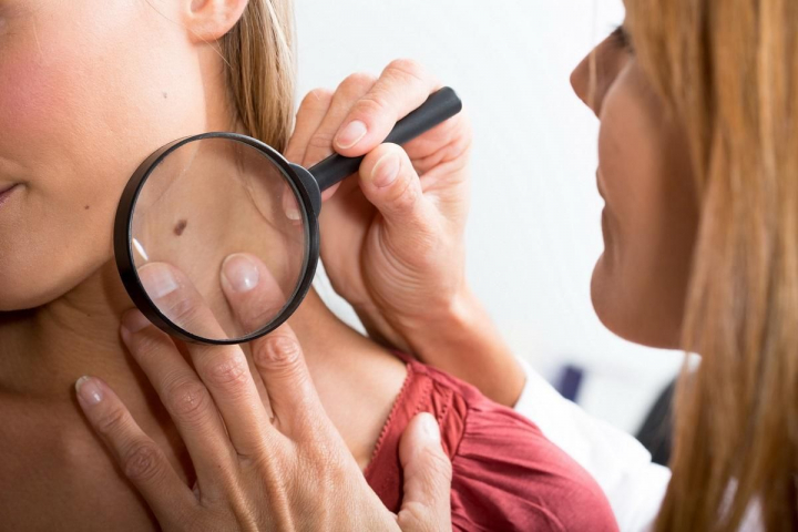 TOP 7 alimente care pot preveni cancerul de piele - FOTO