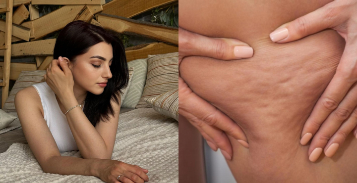 Cristina Bucsa dezvăluie secretele masajului anticelulitic, dar și dacă sunt eficiente cremele anticelulitice: „Adevărul este...” - FOTO Cristina Bucsa dezvăluie secretele masajului anticelulitic, dar și dacă sunt eficiente cremele anticelulitice: „Adevărul este...” - FOTO